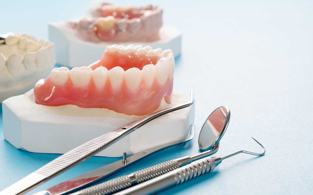 Do You Need Bone Reconstruction Before Getting New Dentures?