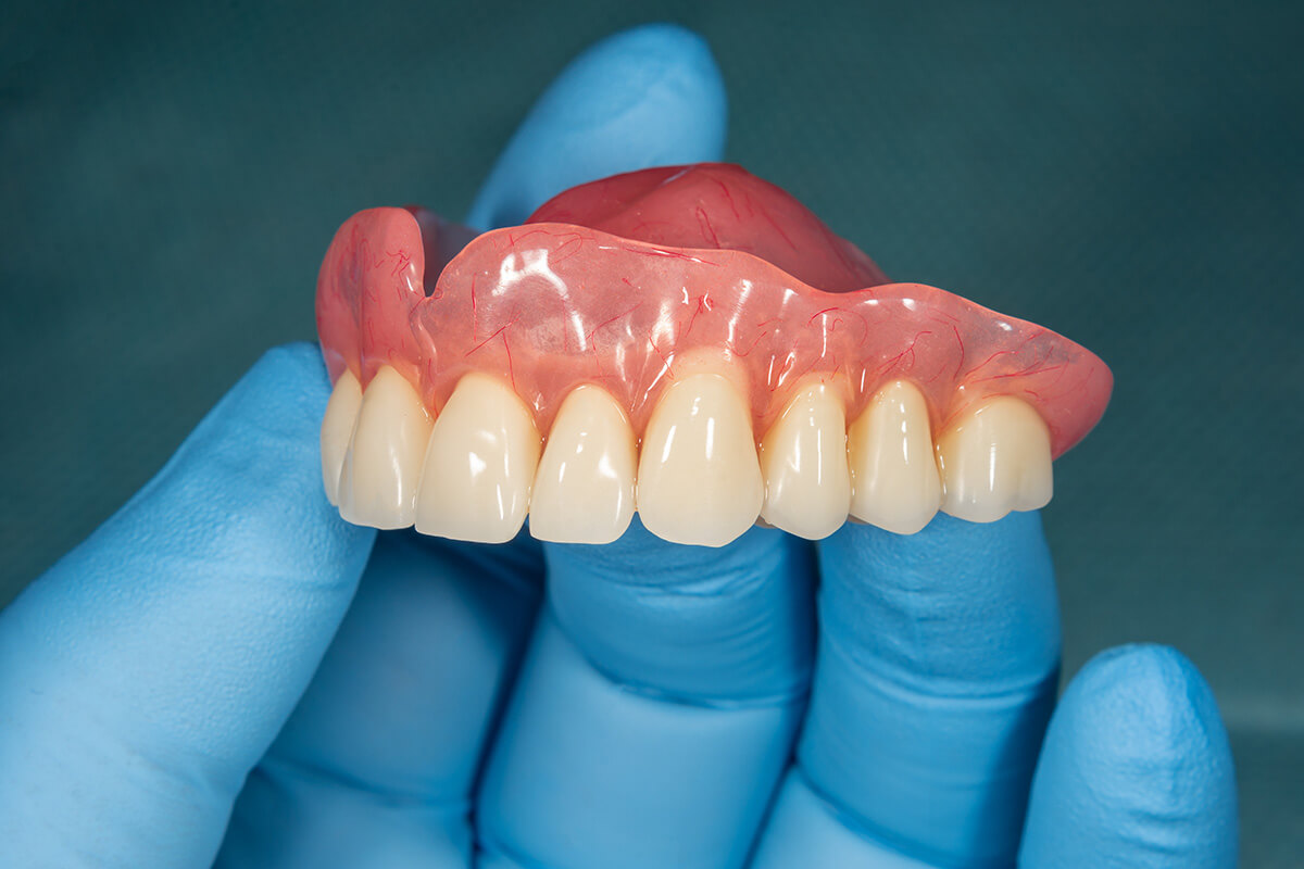 Close-up human denture of the upper jaw