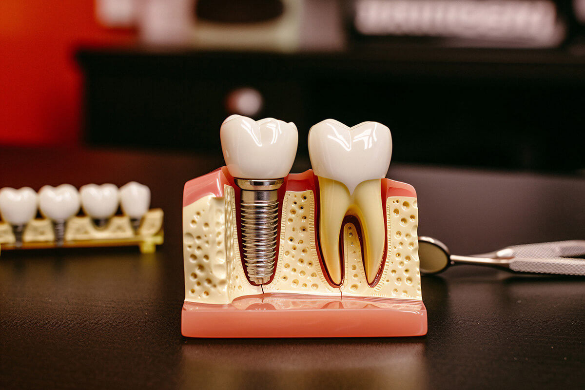 a model of teeth